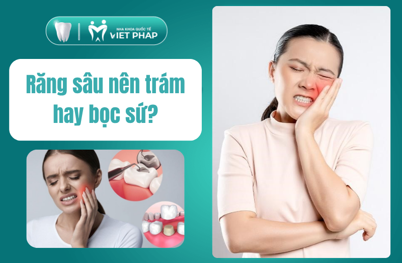 Răng sâu nên trám hay bọc sứ? Ưu nhược điểm, so sánh và cách phòng ngừa hiệu quả