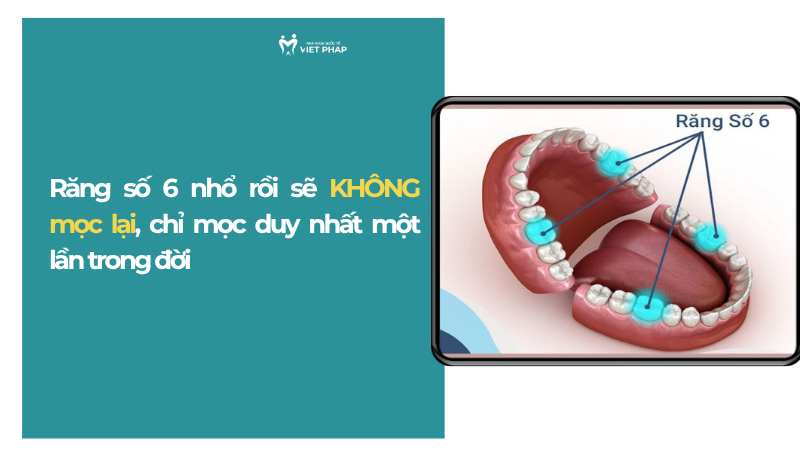 rang so 6 nho roi co moc lai khong 1 Răng số 6 nhổ rồi sẽ KHÔNG mọc lại, chỉ mọc duy nhất một lần trong đời