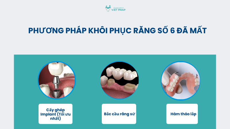 rang so 6 nho roi co moc lai khong 5 Phương pháp khôi phục răng số 6 đã mất