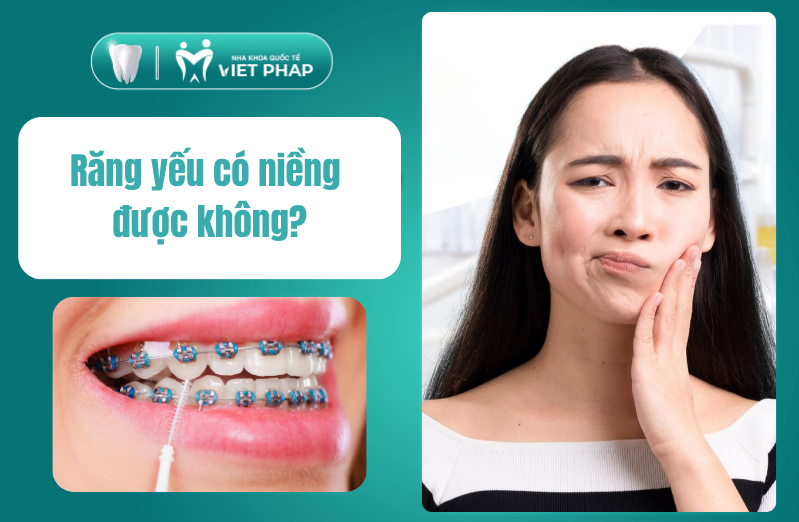 [Giải đáp] Tôi răng yếu có niềng được không? Phương pháp niềng và lưu ý quan trọng cần biết