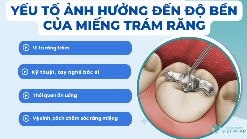 tram rang bang composite co ben khong 3 Yếu tố ảnh hưởng đến độ bền của miếng trám răng