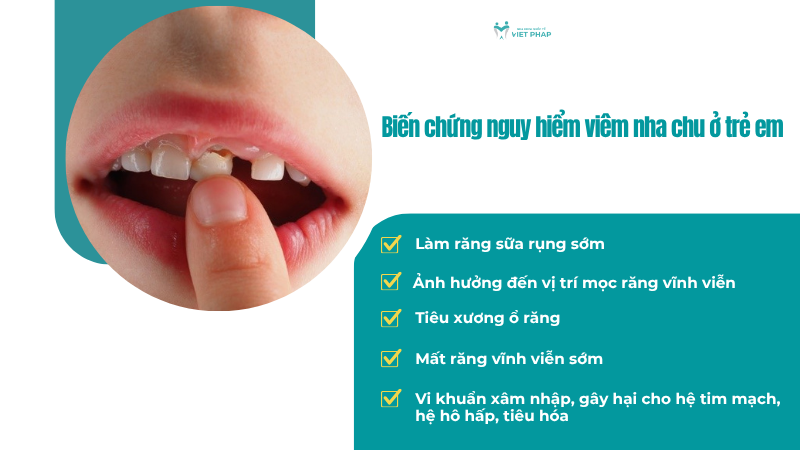 viem nha chu o tre em 5 Biến chứng nguy hiểm viêm nha chu ở trẻ em