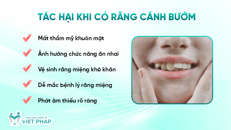Tác hại khi có răng cánh bướm