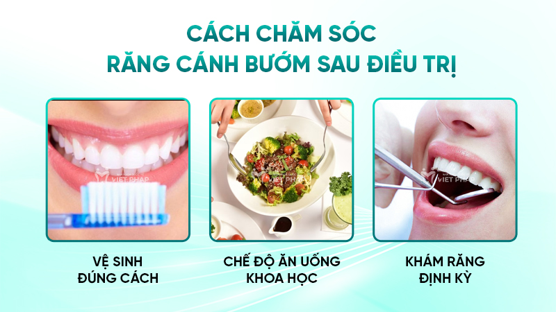 Cách chăm sóc răng cánh bướm sau điều trị