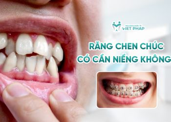 [Giải đáp] Răng chen chúc có cần niềng không? 5 lý do và 3 phương pháp niềng hiệu quả