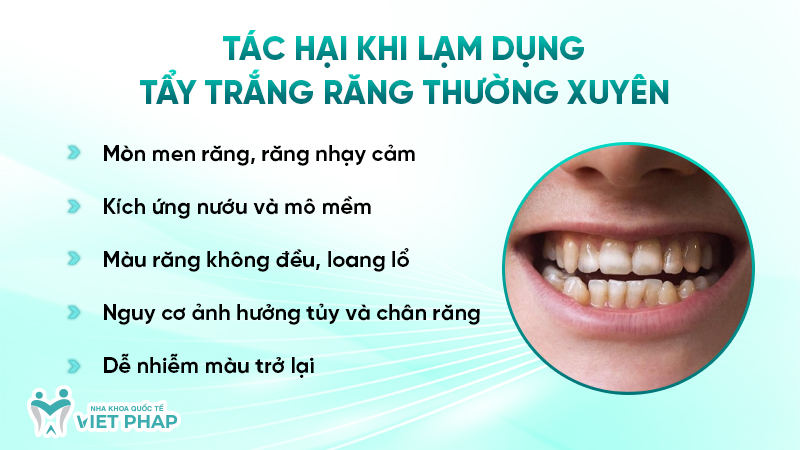 Tác hại khi lạm dụng tẩy trắng răng thường xuyên