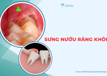 Sưng nướu răng khôn