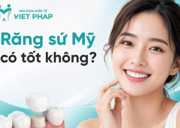 Răng sứ Mỹ có tốt không? Ưu nhược điểm, độ bền, chi phí từ 10.000.000 VNĐ/ răng