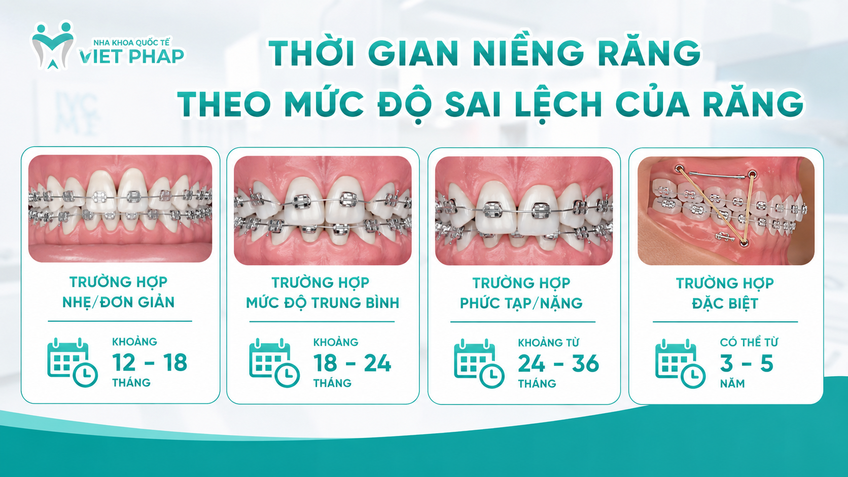 nieng rang nguoi lon mat bao lau 2 Thời gian niềng răng theo mức độ sai lệch của răng