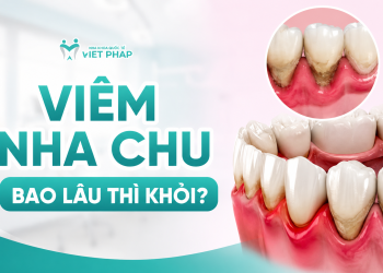 Viêm nha chu bao lâu thì khỏi