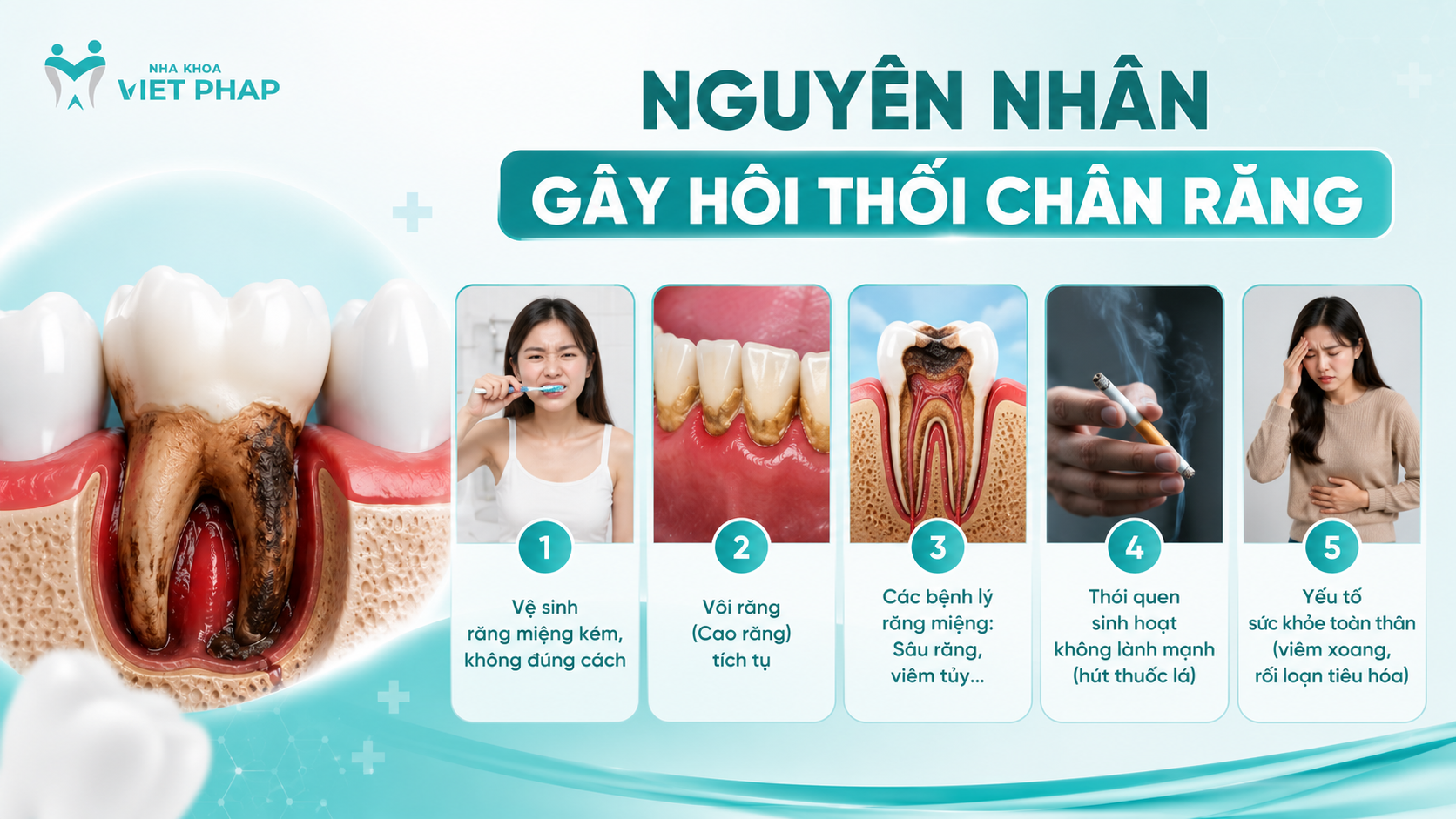 Nguyên nhân gây hôi thối chân răng