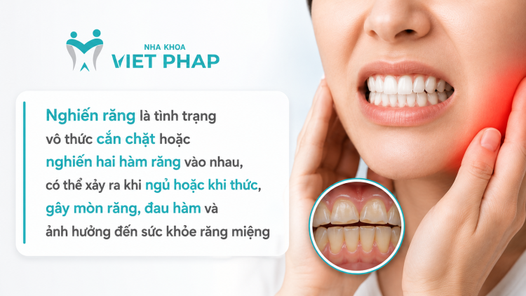 Nghiến răng là tình trạng vô thức cắn chặt hoặc nghiến hai hàm răng vào nhau, có thể xảy ra khi ngủ hoặc khi thức, gây mòn răng, đau hàm và ảnh hưởng đến sức khỏe răng miệng