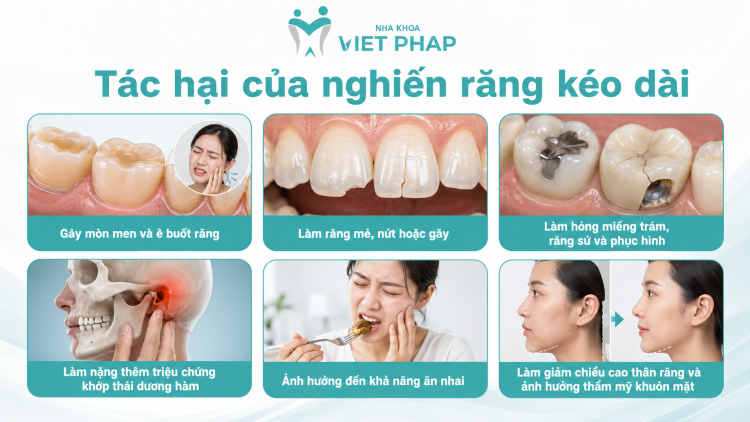 Tác hại của nghiến răng kéo dài