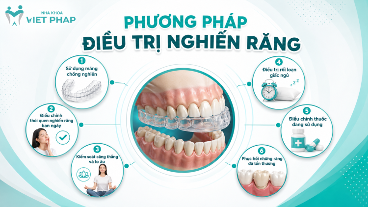 Phương pháp điều trị nghiến răng