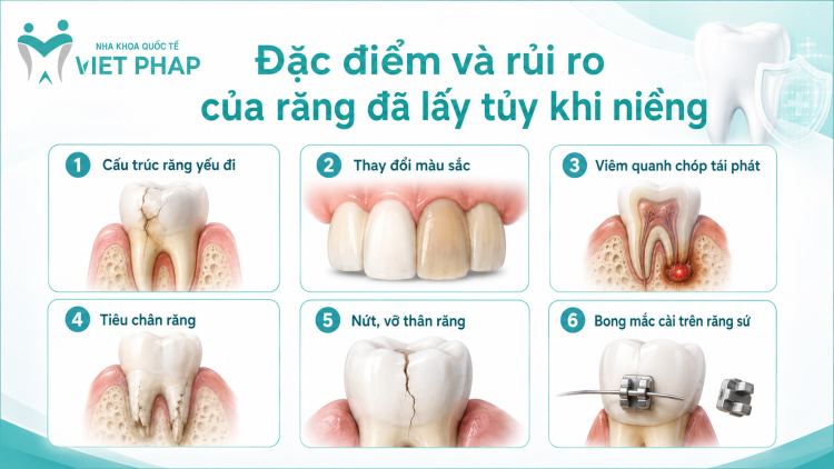 Đặc điểm và rủi ro của răng đã lấy tủy khi niềng