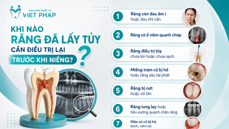 Khi nào răng đã lấy tủy cần điều trị lại trước khi niềng?