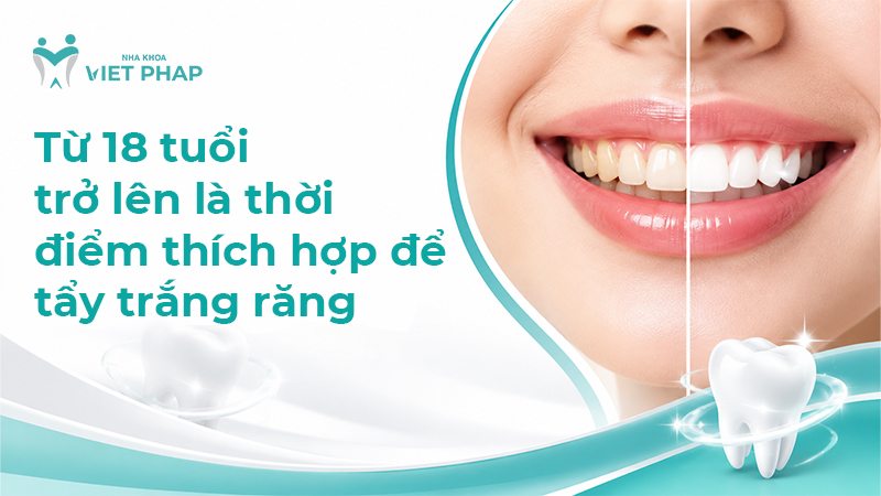 bao nhieu tuoi duoc tay trang rang 1 Từ 18 tuổi trở lên là thời điểm thích hợp để tẩy trắng răng