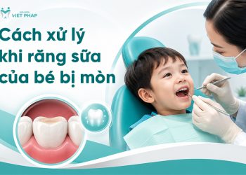 cach xu ly rang sua bi mon 1 Cách xử lý khi răng sữa của trẻ bị mòn theo từng mức độ cha mẹ cần biết