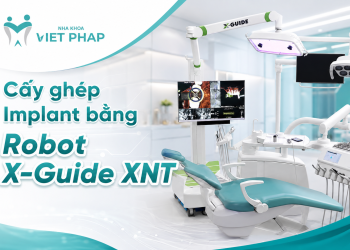 7 Ưu điểm vượt trội cấy ghép Implant bằng Robot X-Guide XNT - chính xác, an toàn tuyệt đối