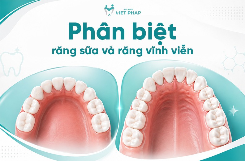 6 điểm phân biệt răng sữa và răng vĩnh viễn cha mẹ cần đặc biệt chú ý