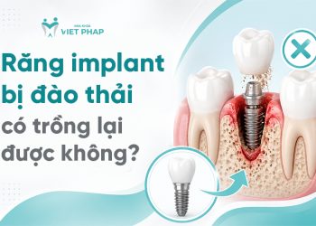 Răng implant bị đào thải có trồng lại được không
