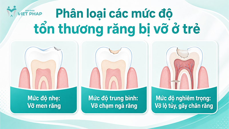 tre bi vo rang 4 Phân loại các mức độ tổn thương răng bị vỡ ở trẻ