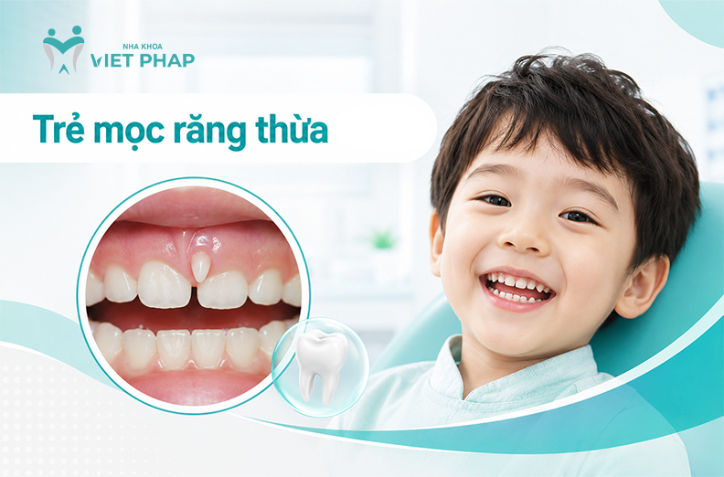 Trẻ mọc thừa răng