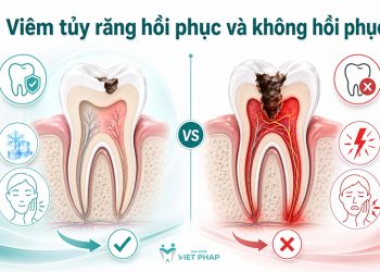 Viêm tủy răng hồi phục và không hồi phục