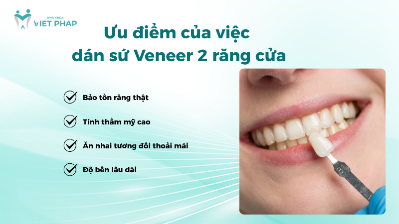 dan su veneer 2 rang 3 Ưu điểm của việc dán sứ Veneer 2 răng cửa