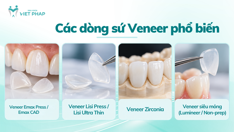 dan su veneer 2 rang 4 Các dòng sứ Veneer phổ biến