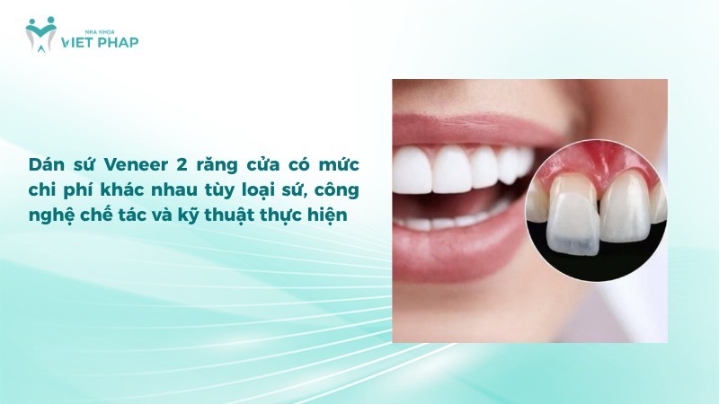 dan su veneer 2 rang 6 Dán sứ Veneer 2 răng cửa có mức chi phí khác nhau tùy loại sứ, công nghệ chế tác và kỹ thuật thực hiện