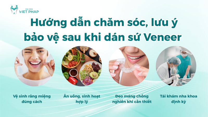 dan su veneer 2 rang 7 Hướng dẫn chăm sóc và lưu ý bảo vệ sau khi dán sứ Veneer