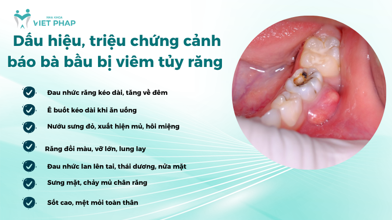 ba bau bi viem tuy rang 2 Dấu hiệu, triệu chứng cảnh báo bà bầu bị viêm tủy răng