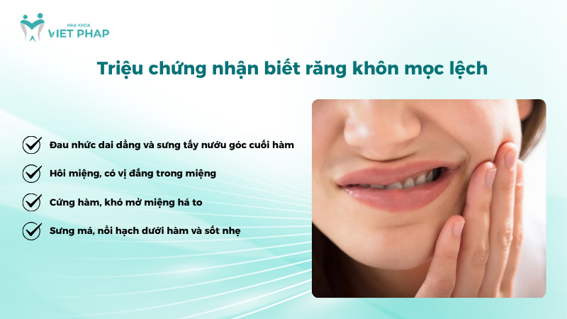 Triệu chứng nhận biết răng khôn mọc lệc