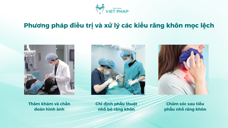 Phương pháp điều trị và xử lý các kiểu răng khôn mọc lệch
