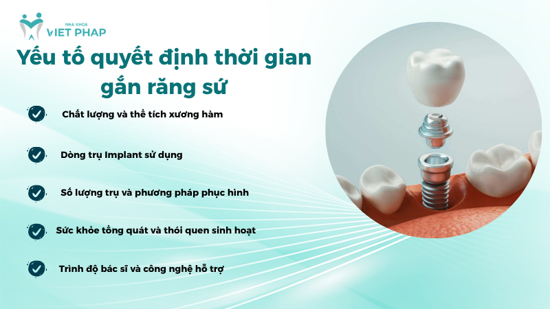 Yếu tố quyết định thời gian gắn răng sứ