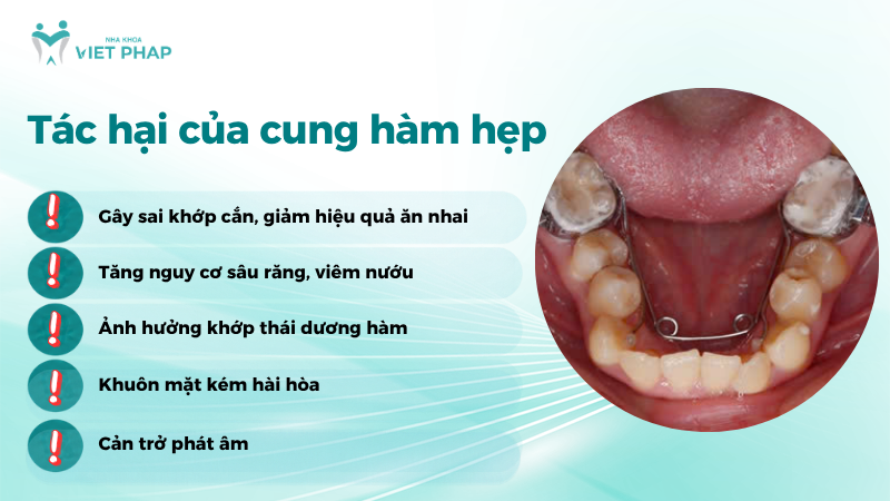 cung ham hep 3 Tác hại của cung hàm hẹp