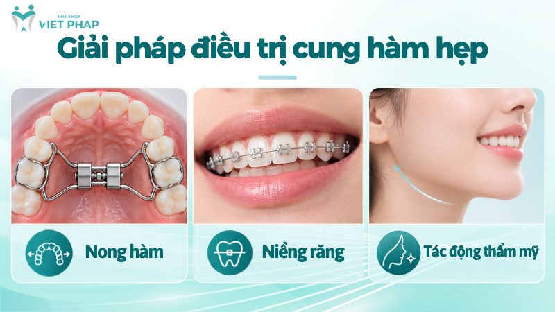 cung ham hep 4 Giải pháp điều trị cung hàm hẹp