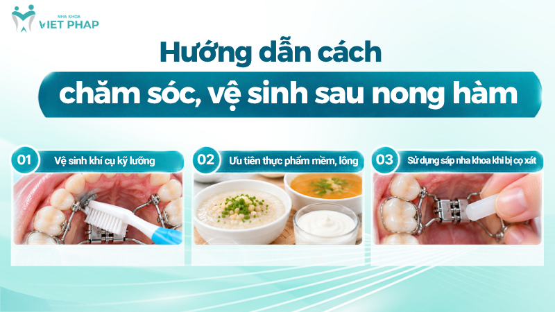 cung ham hep 5 Hướng dẫn cách chăm sóc, vệ sinh sau nong hàm