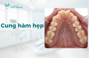 cung ham hep Thumb