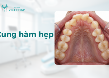 Cung hàm hẹp phải làm sao? Dấu hiệu, nguyên nhân, tác hại và cách điều trị hiệu quả