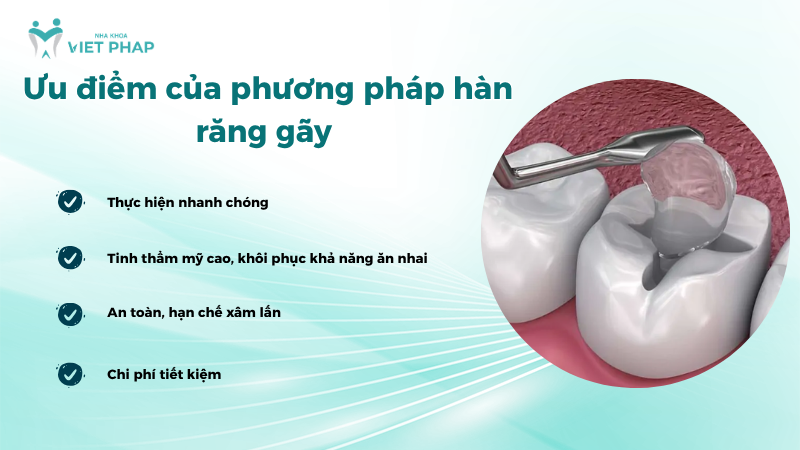 Ưu điểm của phương pháp hàn răng gãy