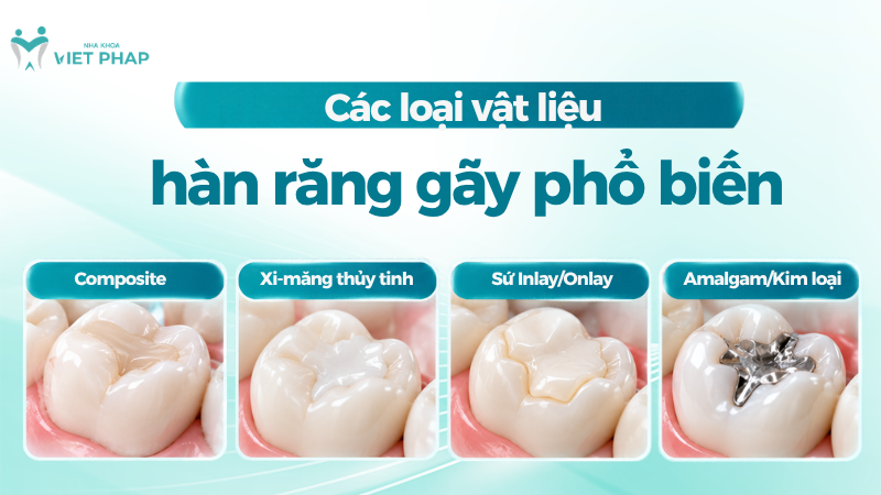 Các laoij vật liệu hàn răng gãy phổ biến