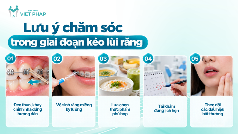 Lưu ý chăm sóc trong giai đoạn kéo lùi răng