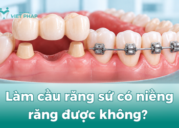 Làm cầu răng sứ có niềng răng được không?