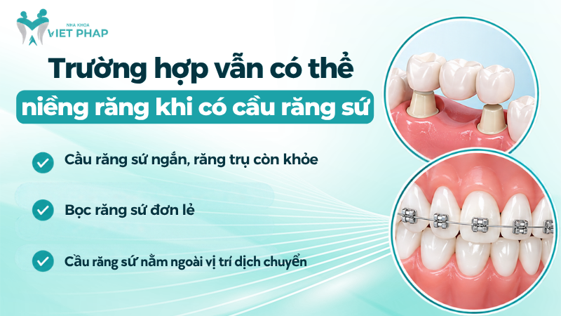 Trường hợp vẫn có thể niềng răng khi có cầu răng sứ: cầu sứ ngắn, răng trụ còn khỏe, bọc răng sứ đơn lẻ hoặc cầu sứ nằm ngoài vị trí dịch chuyển