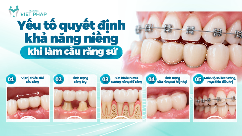 5 yếu tố quyết định khả năng niềng răng khi đã làm cầu răng sứ