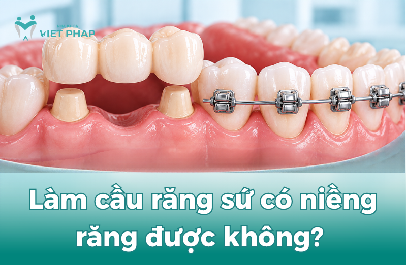 Làm cầu răng sứ có niềng răng được không?