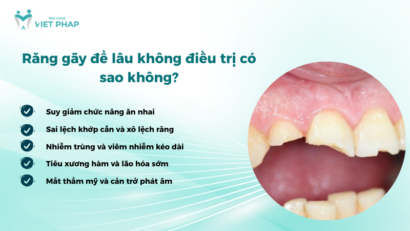 lam gi khi rang bi gay 6 Răng gãy để lâu không điều trị có sao không?