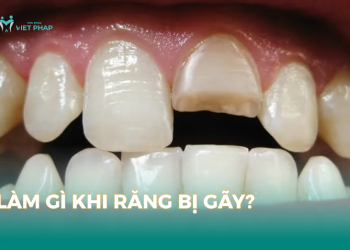 Làm gì khi răng bị gãy?